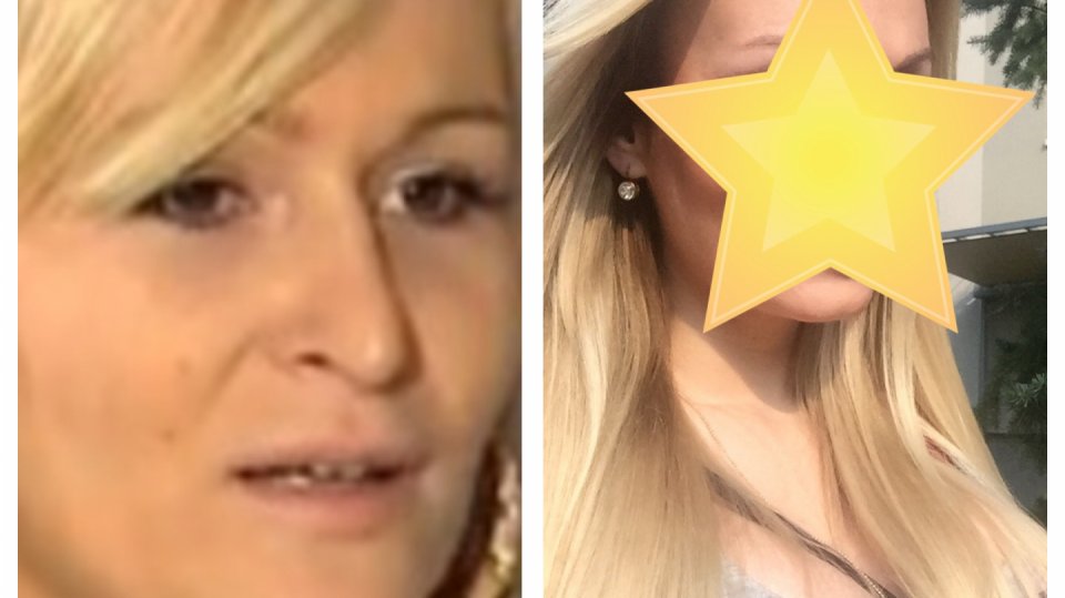 Eva F. má nový nos
